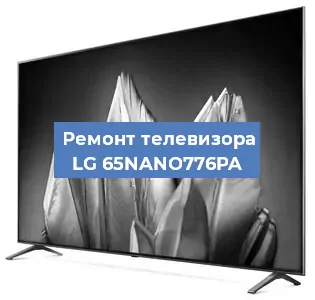 Замена динамиков на телевизоре LG 65NANO776PA в Новосибирске